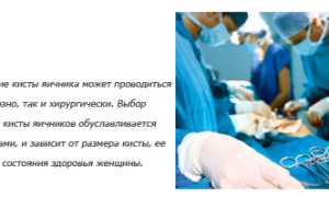 Лечение кисты яичника без операции