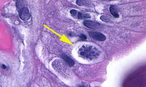 Isospora belli: загадочный паразит и его влияние на здоровье человека