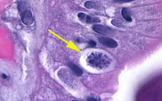 Isospora belli: загадочный паразит и его влияние на здоровье человека