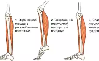 Почему сохнет икроножная мышца и что с этим делать