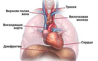 Тимома средостения: что это такое простыми словами