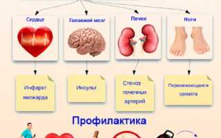 Атеросклероз коронарных артерий — основные симптомы и признаки