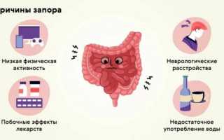 Температура при запоре — возможные причины и симптомы