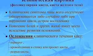 Осложнение и лечение геморрагической кисты яичника