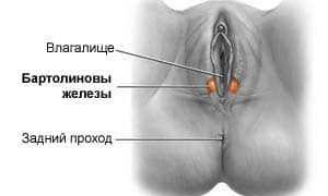 Все о кисте бартолиновой железы