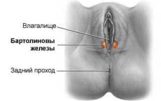 Все о кисте бартолиновой железы