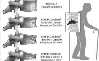 Последствия перелома 4 позвонка