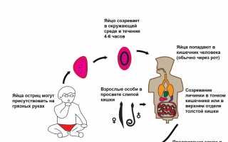 Симптомы острицы у взрослых