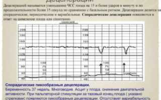 При ктг 1 децелерация