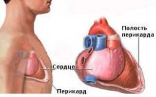 Симптомы и лечение кисты перикарда