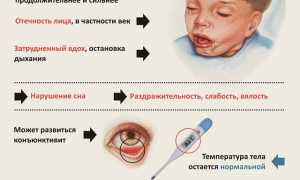 Что значит коклюш: понимание болезни и её последствий