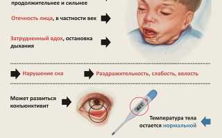 Что значит коклюш: понимание болезни и её последствий