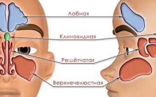 Симптомы и лечение кисты лобной пазухи