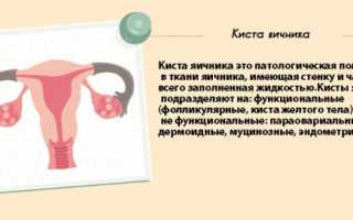 Можно ли заниматься спортом при кисте на яичнике
