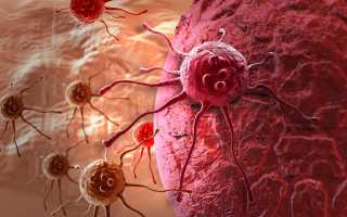 Несколько фактов об онкологии