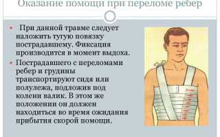 Повязки при переломе ребер — виды и правила применения