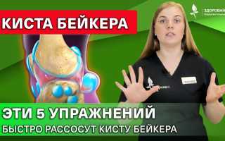 Лечение кисты в домашних условиях — эффективные методы