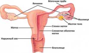 Симптомы и лечение склерокистоза яичников