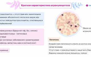Повышенное количество гранулоцитов у женщин — причины и последствия