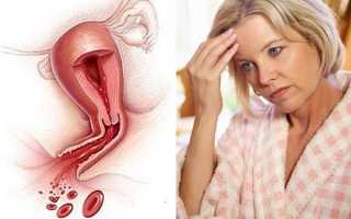Причины кровянистых выделений в период менопаузы