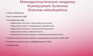 Миелодиспластический синдром: разберемся, что это такое