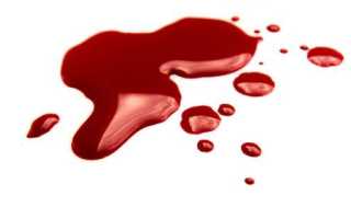 К чему снится менструационная кровь во сне женщине