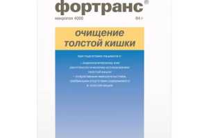 Фольтранс — история и особенности