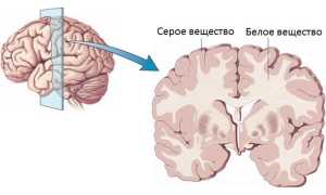 Что такое белое вещество головного мозга