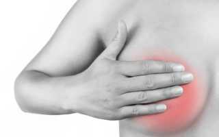 Почему болят грудные (молочные) железы при климаксе