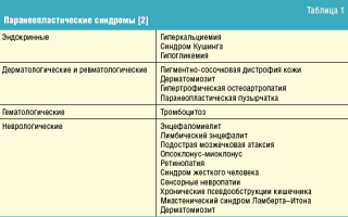 Паранеопластический синдром: что это такое и как он влияет на здоровье