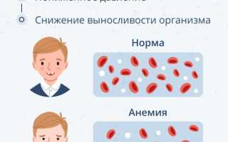 Анемия 1 степени у ребенка до года — причины, симптомы и лечение