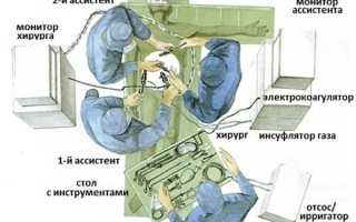 Меры подготовки к лапароскопии кисты яичника