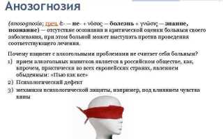 Анозогнозия: понимание состояния, его причины и влияние на жизнь