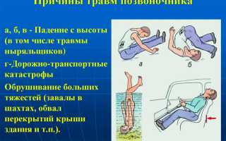 Компрессионный перелом L4 — причины, симптомы и лечение