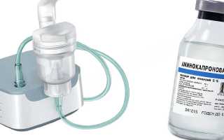 Ингаляции аминокапроновой кислотой через небулайзер