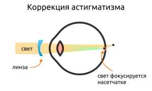 Что такое патология рефракции глаза и как она влияет на наше зрение?