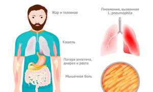 Легионелла: что это такое и как распознать симптомы