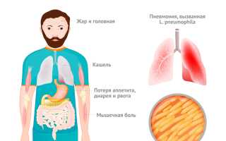 Легионелла: что это такое и как распознать симптомы