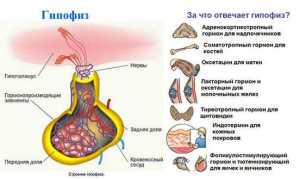Все о кисте гипофиза головного мозга