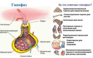 Все о кисте гипофиза головного мозга