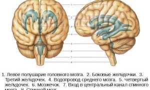 Асимметрия и увеличение боковых желудочков головного мозга