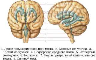 Асимметрия и увеличение боковых желудочков головного мозга