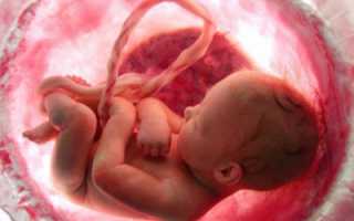 Чем опасны кисты урахуса и в каких случаях нужна операция