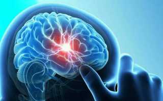 Основные симптомы сотрясения мозга