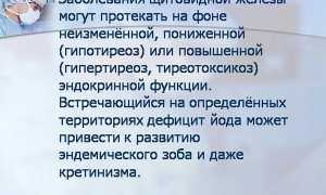 Показания к проведению УЗИ щитовидной железы