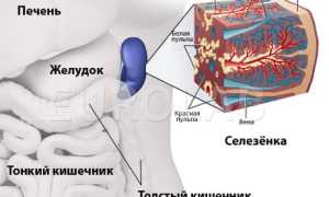 Симптомы и лечение кисты селезенки у ребенка