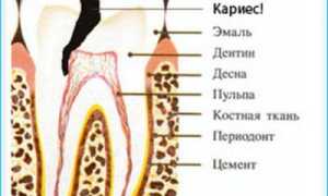 Как определить кисту зуба на рентгеновском снимке