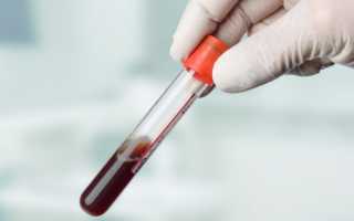 Гормональный анализ крови: кому, где и зачем