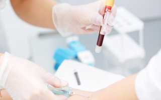Можно ли сдавать анализ крови при месячных
