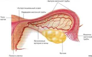 Симптомы и лечение кисты маточной трубы